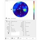 Resultados prueba estática AP600