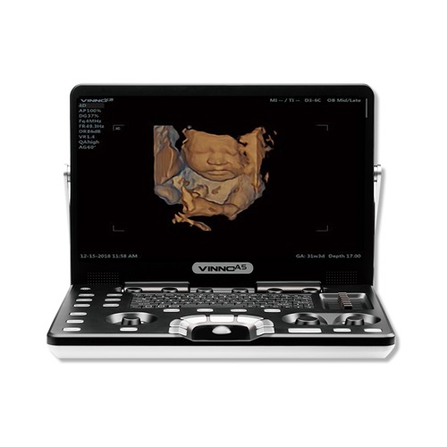 Ultrasonido portatil 15" digital sin transductores Mod. A5 para cardio con modulos ECG y CW