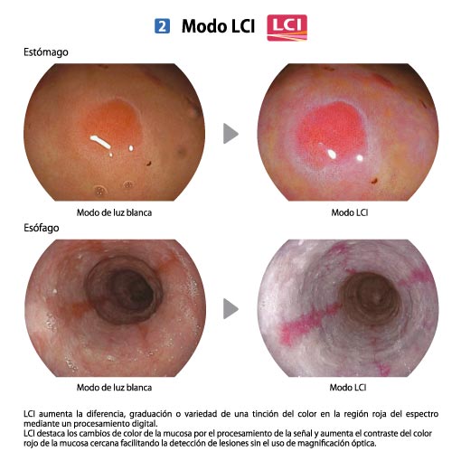 MODO LCI