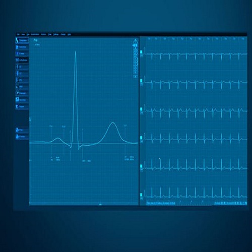 Licencia CardioPoint C600, Software`avanzado para conectar a PC para el electrocardiografos BTL