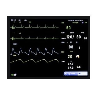 Monitor para paciente de signos vitales 12.1" Zafiro F series 6 parametros