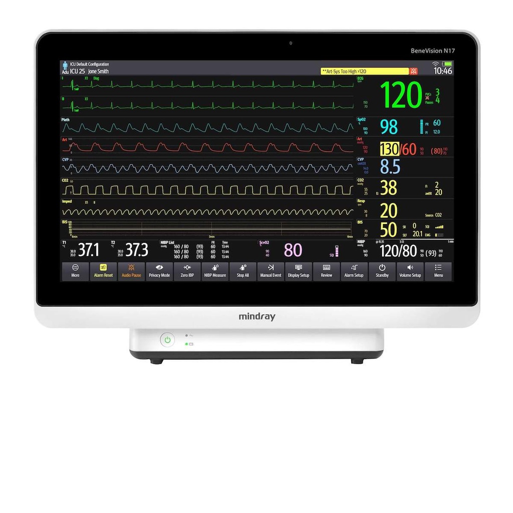 Monitor para paciente de signos vitales Benevision N12 6 parametros Pantalla 12.1"