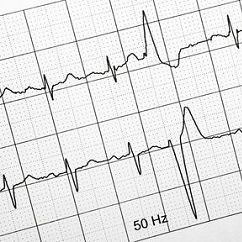 Papel para ECG en Z de 100mm x 150mm 180 hojas caja con 10 paquetes