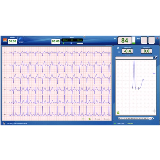 Programa CardioSW – Stress para pruebas de Esfuerzo para equipos CV200 / CV1200