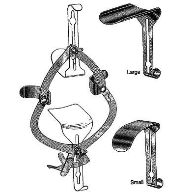 Separador o retractor abdominal O´SULLIVAN.O CONNOR