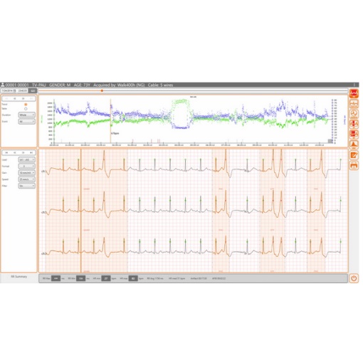 Software CubeHolter para la interpretación de estudios holter