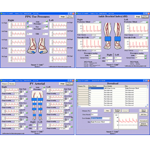 Software V-Link O Fetal Link para PC Windows para doppler ES100V3, SD30, SD50