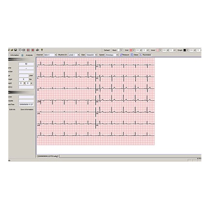 Software y cable para monitoreo en PC para ECG CARDIO7