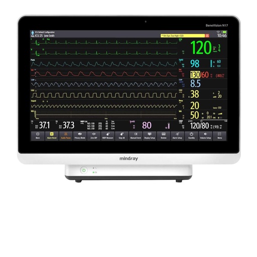 [MIN-MV-N12] Monitor para paciente de signos vitales Benevision N12 6 parametros Pantalla 12.1"